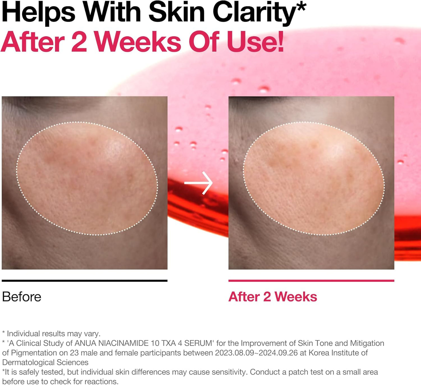 سيروم ANUA 10% نياسيناميد + 4% TXA، سيراميد، حمض الهيالورونيك، حمض الترانيكساميك، فيتامين B12، لون طبيعي، بشرة كورية زجاجية، خالٍ من العطور، سيروم للبقع الداكنة، العناية بالبشرة الكورية 